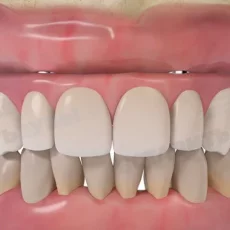 Стоматологическая клиника Зубы за 1 день фотография 1