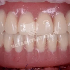 Стоматологическая клиника Зубы за 1 день фотография 6