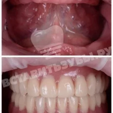 Стоматологическая клиника Зубы за 1 день фотография 4
