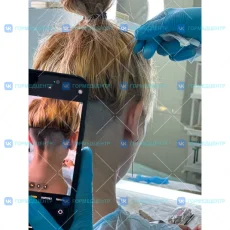 Клиника ГМЦ Пересадка волос фотография 17