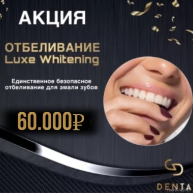 Акция! Отбеливание зубов Luxe без перекиси всего за 60.000₽